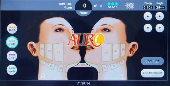 3.0mm 4.5mm 2D HIFU уменьшая кожу машины затягивая удаление морщинки